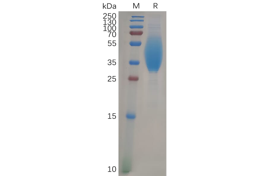 SDS-PAGE - Recombinant Human CEACAM6 Protein (6×His Tag) (A317968) - Antibodies.com