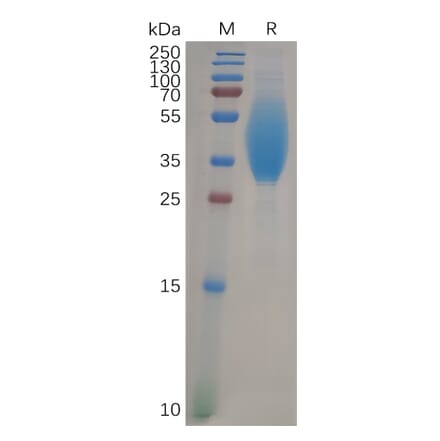 SDS-PAGE - Recombinant Human CEACAM6 Protein (6×His Tag) (A317968) - Antibodies.com