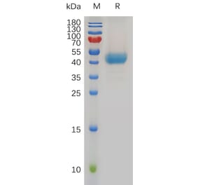 SDS-PAGE - Recombinant Human CXCR1 Protein (Fc Tag) (A317969) - Antibodies.com