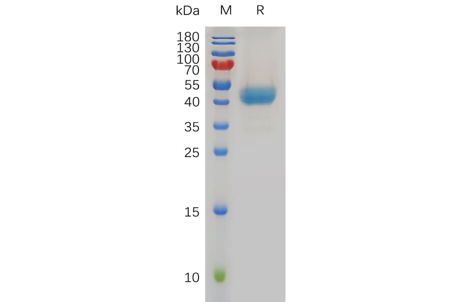 SDS-PAGE - Recombinant Human CXCR1 Protein (Fc Tag) (A317969) - Antibodies.com