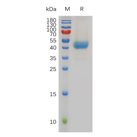 SDS-PAGE - Recombinant Human CXCR1 Protein (Fc Tag) (A317969) - Antibodies.com
