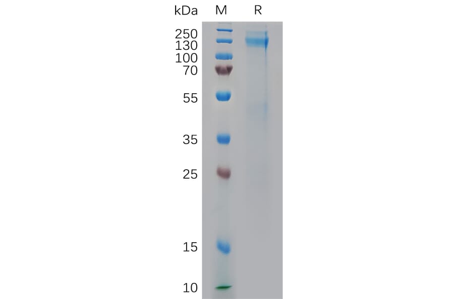 SDS-PAGE - Recombinant Human IGF1 Receptor Protein (6×His Tag) (A317971) - Antibodies.com