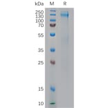 SDS-PAGE - Recombinant Human IGF1 Receptor Protein (6×His Tag) (A317971) - Antibodies.com