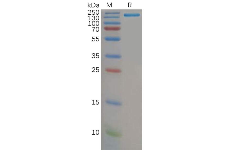 SDS-PAGE - Recombinant Human CD21 Protein (Fc Tag) (A317972) - Antibodies.com