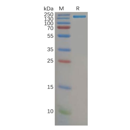 SDS-PAGE - Recombinant Human CD21 Protein (Fc Tag) (A317972) - Antibodies.com