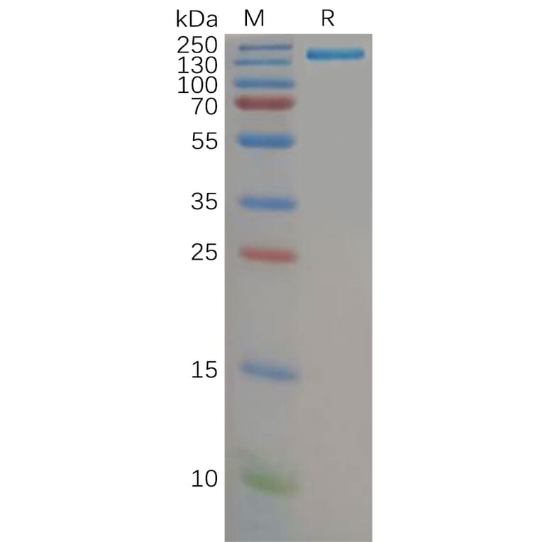 SDS-PAGE - Recombinant Human CD21 Protein (Fc Tag) (A317972) - Antibodies.com