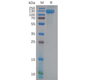 SDS-PAGE - Recombinant Human CD13 Protein (6×His Tag) (A317974) - Antibodies.com