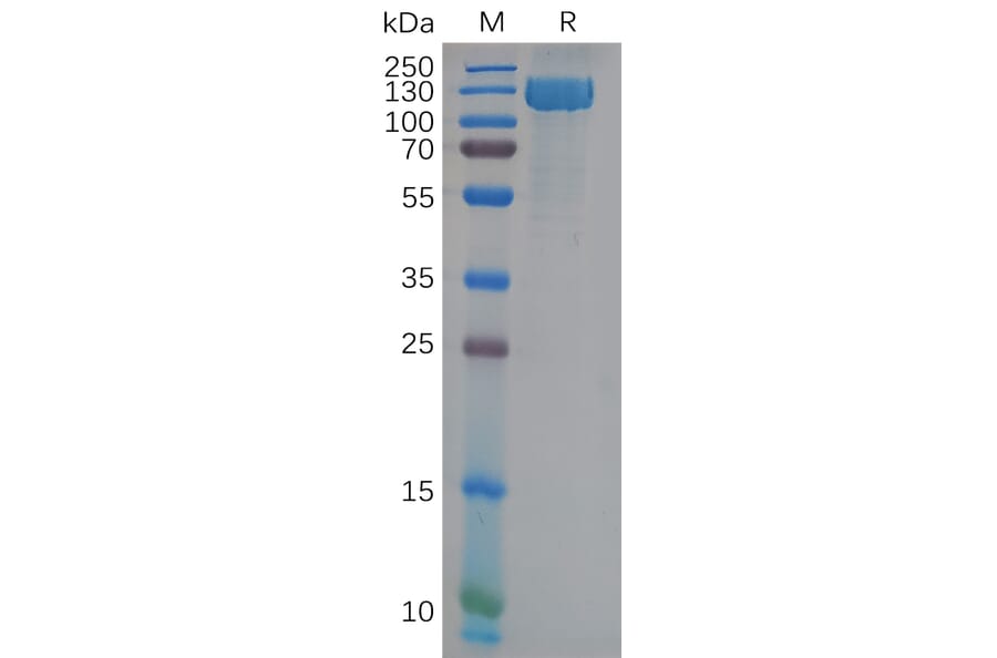 SDS-PAGE - Recombinant Human CD13 Protein (6×His Tag) (A317974) - Antibodies.com