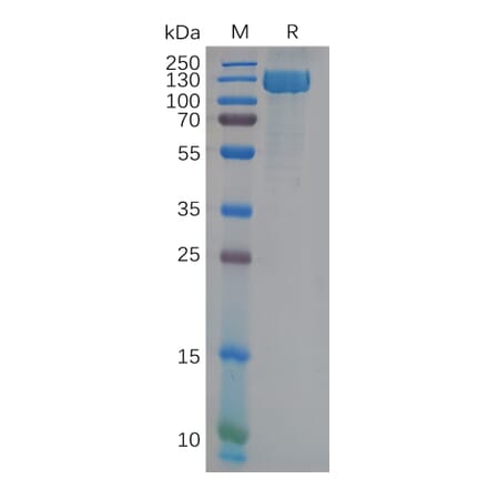 SDS-PAGE - Recombinant Human CD13 Protein (6×His Tag) (A317974) - Antibodies.com