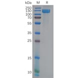 SDS-PAGE - Recombinant Human CD13 Protein (6×His Tag) (A317974) - Antibodies.com
