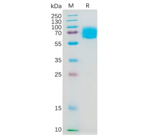 SDS-PAGE - Recombinant Human IL-4R Protein (Fc Tag) (A317975) - Antibodies.com