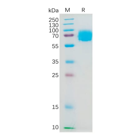 SDS-PAGE - Recombinant Human IL-4R Protein (Fc Tag) (A317975) - Antibodies.com