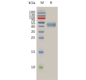 SDS-PAGE - Recombinant Human Somatostatin Receptor 2 Protein (Fc Tag) (A317976) - Antibodies.com