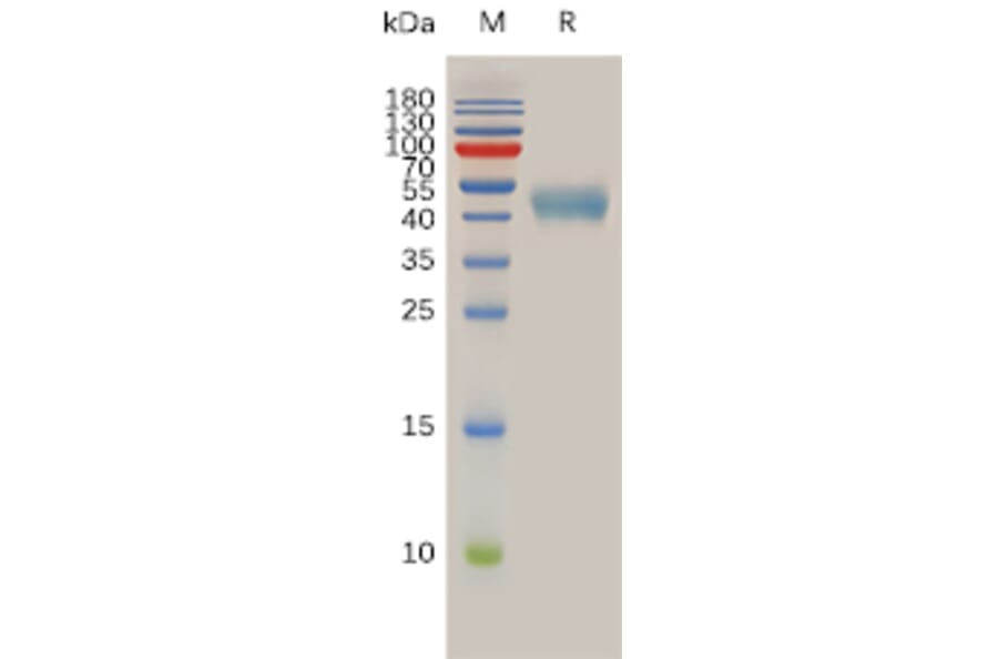 SDS-PAGE - Recombinant Human Somatostatin Receptor 2 Protein (Fc Tag) (A317976) - Antibodies.com