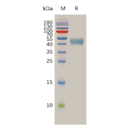 SDS-PAGE - Recombinant Human Somatostatin Receptor 2 Protein (Fc Tag) (A317976) - Antibodies.com