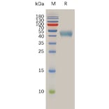 SDS-PAGE - Recombinant Human Somatostatin Receptor 2 Protein (Fc Tag) (A317976) - Antibodies.com