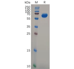 SDS-PAGE - Recombinant Human GPA33 Protein (Fc Tag) (A317977) - Antibodies.com