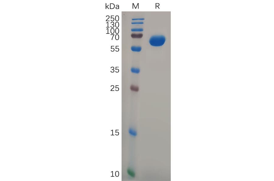 SDS-PAGE - Recombinant Human GPA33 Protein (Fc Tag) (A317977) - Antibodies.com
