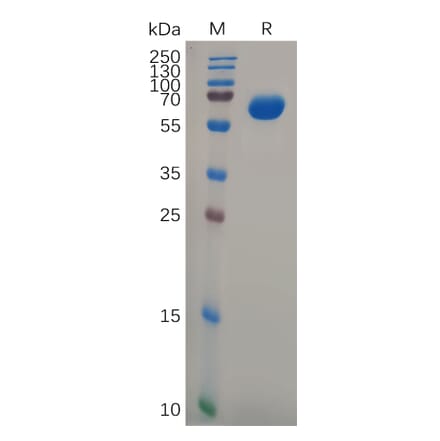 SDS-PAGE - Recombinant Human GPA33 Protein (Fc Tag) (A317977) - Antibodies.com