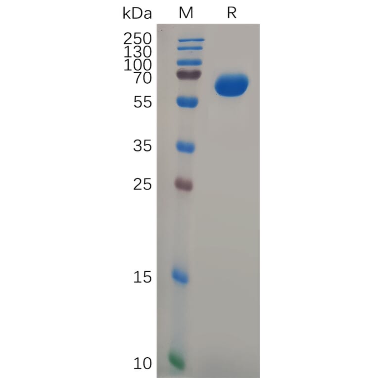 SDS-PAGE - Recombinant Human GPA33 Protein (Fc Tag) (A317977) - Antibodies.com