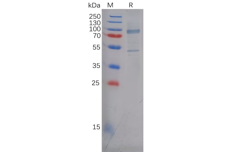 SDS-PAGE - Recombinant Human P Cadherin Protein (6×His Tag) (A317978) - Antibodies.com