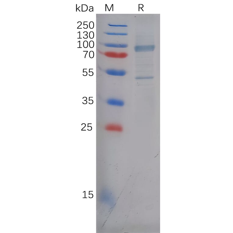 SDS-PAGE - Recombinant Human P Cadherin Protein (6×His Tag) (A317978) - Antibodies.com