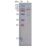 SDS-PAGE - Recombinant Human P Cadherin Protein (6×His Tag) (A317978) - Antibodies.com