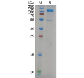 SDS-PAGE - Recombinant Human LI Cadherin Protein (6×His Tag) (A317979) - Antibodies.com
