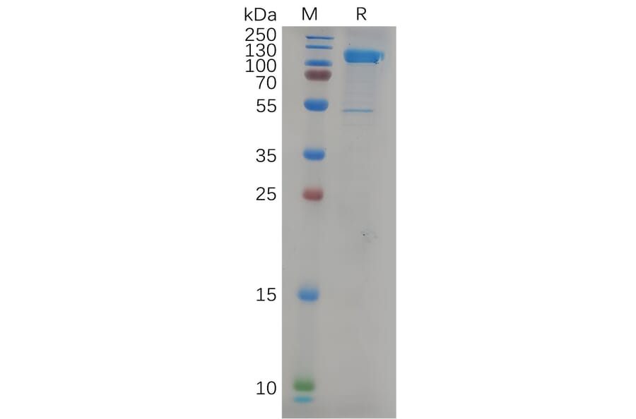 SDS-PAGE - Recombinant Human LI Cadherin Protein (6×His Tag) (A317979) - Antibodies.com