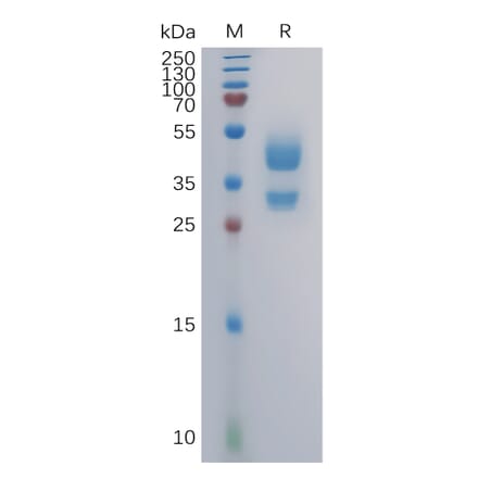 SDS-PAGE - Recombinant Human CXCR3 Protein (Fc Tag) (A317980) - Antibodies.com