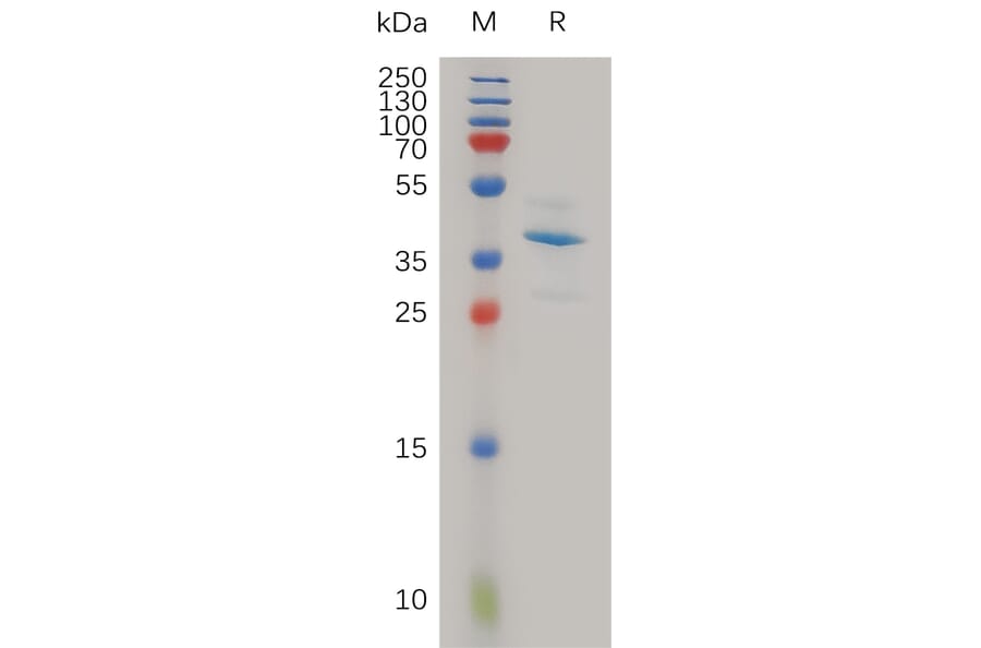SDS-PAGE - Recombinant Human SLPI Protein (Fc Tag) (A317981) - Antibodies.com