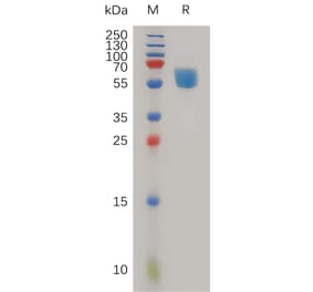 SDS-PAGE - Recombinant Human TREM1 Protein (Fc Tag) (A317982) - Antibodies.com