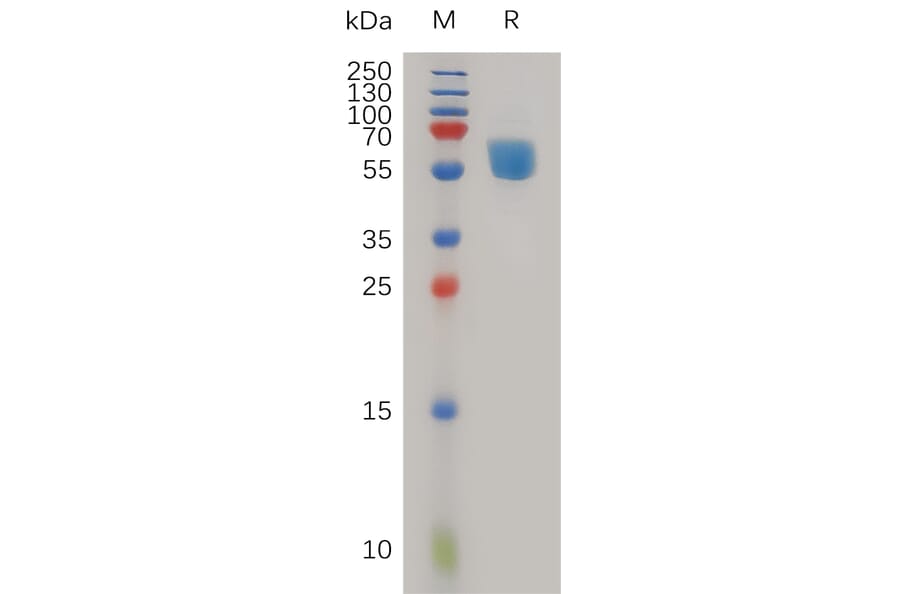 SDS-PAGE - Recombinant Human TREM1 Protein (Fc Tag) (A317982) - Antibodies.com