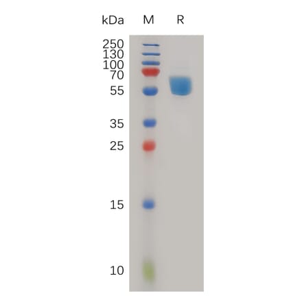 SDS-PAGE - Recombinant Human TREM1 Protein (Fc Tag) (A317982) - Antibodies.com