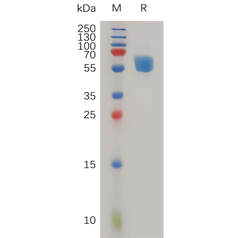SDS-PAGE - Recombinant Human TREM1 Protein (Fc Tag) (A317982) - Antibodies.com