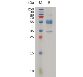 SDS-PAGE - Recombinant Human MAGP2 Protein (Fc Tag) (A317983) - Antibodies.com