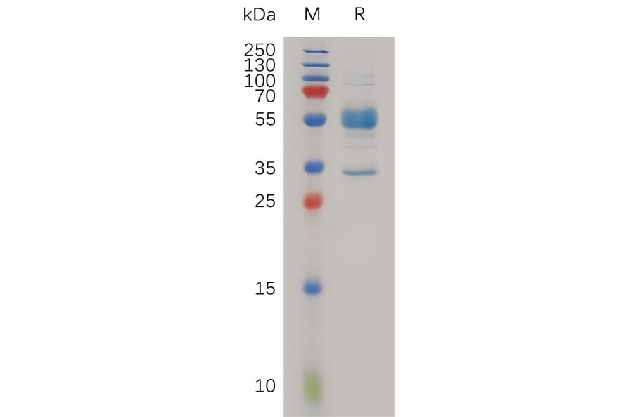 SDS-PAGE - Recombinant Human MAGP2 Protein (Fc Tag) (A317983) - Antibodies.com