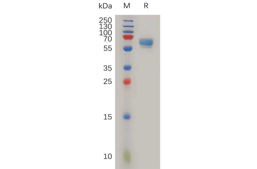 SDS-PAGE - Recombinant Human LTBR Protein (Fc Tag) (A317986) - Antibodies.com