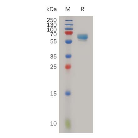 SDS-PAGE - Recombinant Human LTBR Protein (Fc Tag) (A317986) - Antibodies.com
