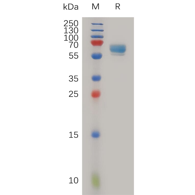 SDS-PAGE - Recombinant Human LTBR Protein (Fc Tag) (A317986) - Antibodies.com