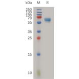 SDS-PAGE - Recombinant Human LTBR Protein (Fc Tag) (A317986) - Antibodies.com