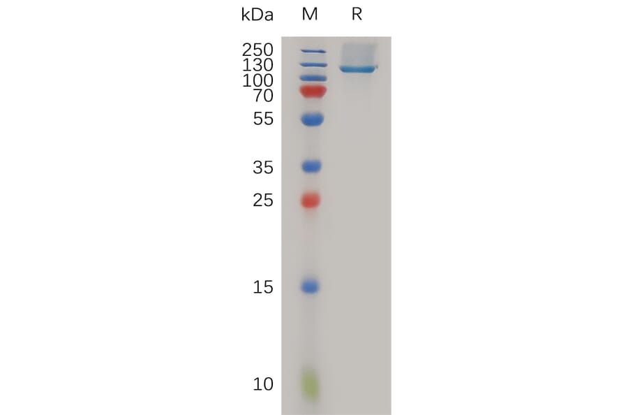 SDS-PAGE - Recombinant Human Neuropilin 1 Protein (6×His Tag) (A317987) - Antibodies.com