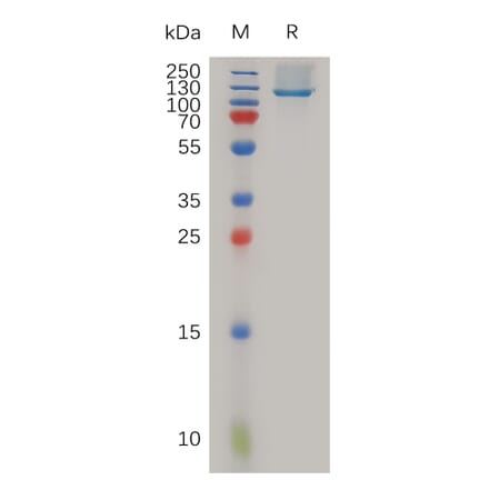 SDS-PAGE - Recombinant Human Neuropilin 1 Protein (6×His Tag) (A317987) - Antibodies.com