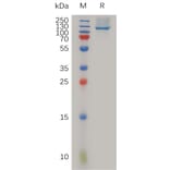 SDS-PAGE - Recombinant Human Neuropilin 1 Protein (6×His Tag) (A317987) - Antibodies.com