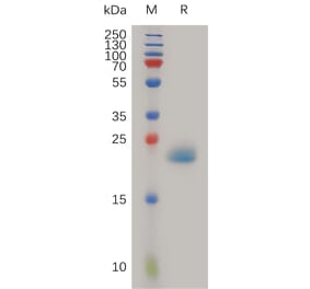SDS-PAGE - Recombinant Human PGRPS Protein (6×His Tag) (A317988) - Antibodies.com