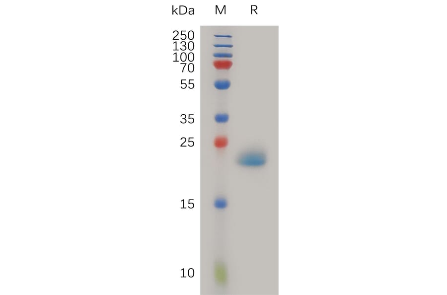 SDS-PAGE - Recombinant Human PGRPS Protein (6×His Tag) (A317988) - Antibodies.com