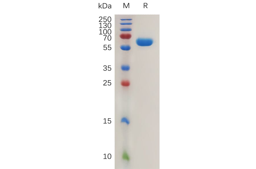 SDS-PAGE - Recombinant Human Carbonic Anhydrase 12/CA12 Protein (Fc Tag) (A317990) - Antibodies.com