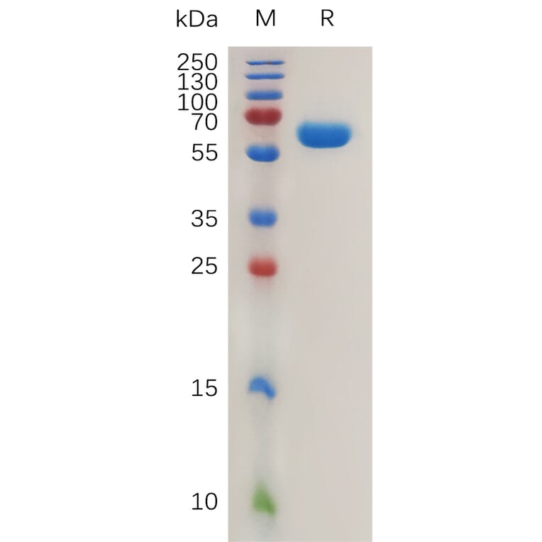 SDS-PAGE - Recombinant Human Carbonic Anhydrase 12/CA12 Protein (Fc Tag) (A317990) - Antibodies.com