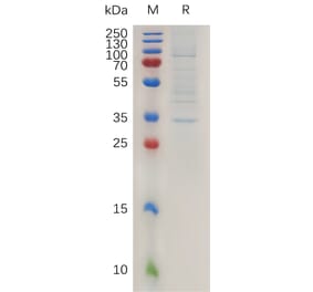 SDS-PAGE - Recombinant Human Claudin 2 Protein (Fc Tag) (A317993) - Antibodies.com