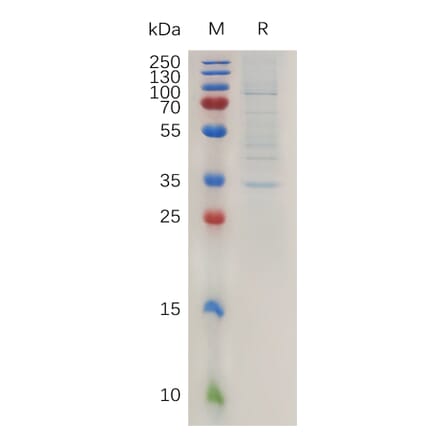 SDS-PAGE - Recombinant Human Claudin 2 Protein (Fc Tag) (A317993) - Antibodies.com